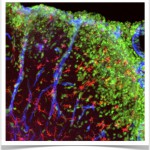 Monocytes